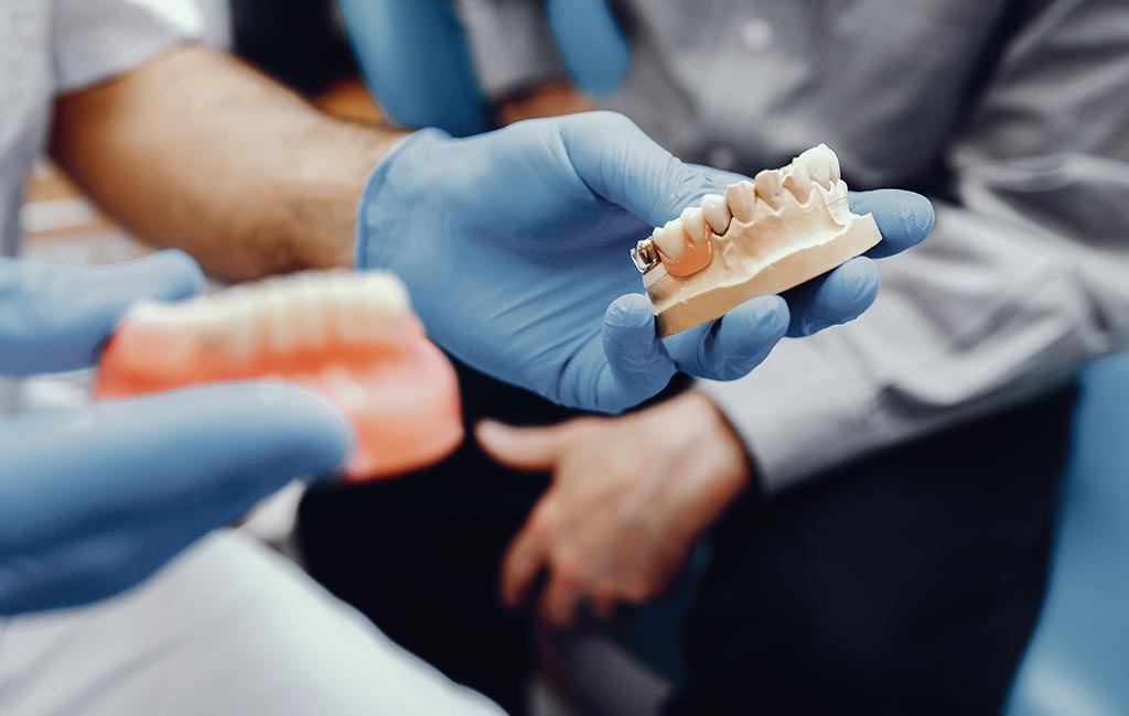 Dental Implants