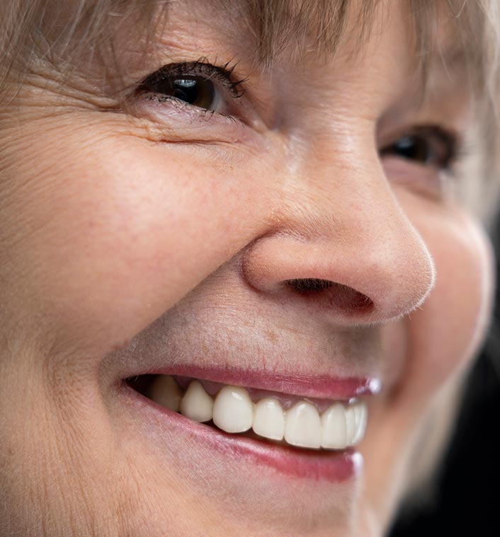 Benefiting from Dental Implants