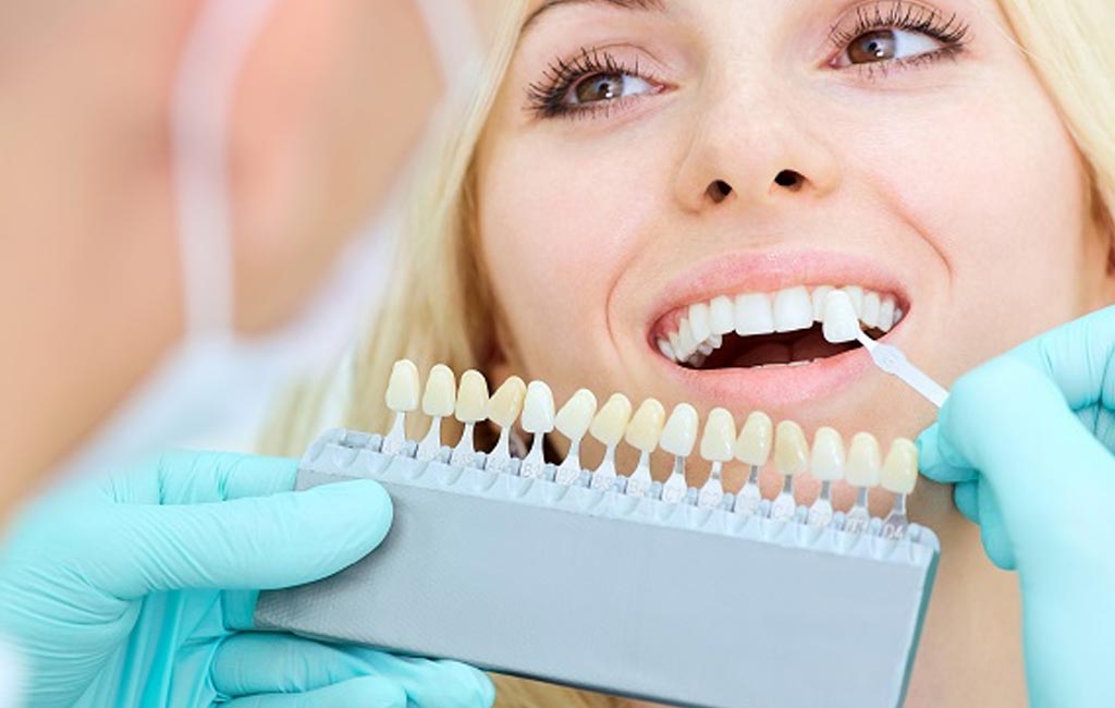 Veneer Treatment